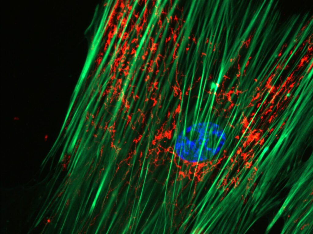 Cell seen by fluorescence microscopy