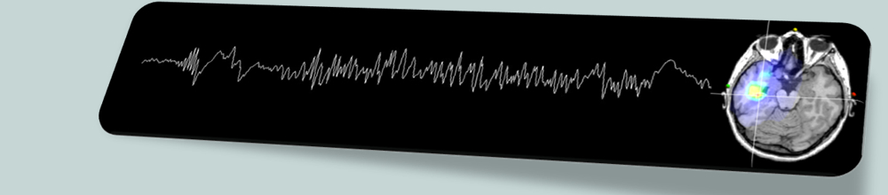 image bandeau Eq ERCN ter